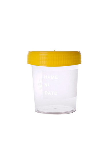 Urine Specimen Cup With Screw Cap Yellow Sterile Heinz Herenz Urine Specimen Cup With Screw Cap Yellow Sterile Heinz Herenz